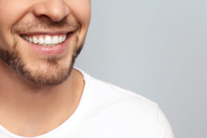 Close up of man’s smile with dental implants after dentist uses X-Guide Dynamic 3D System